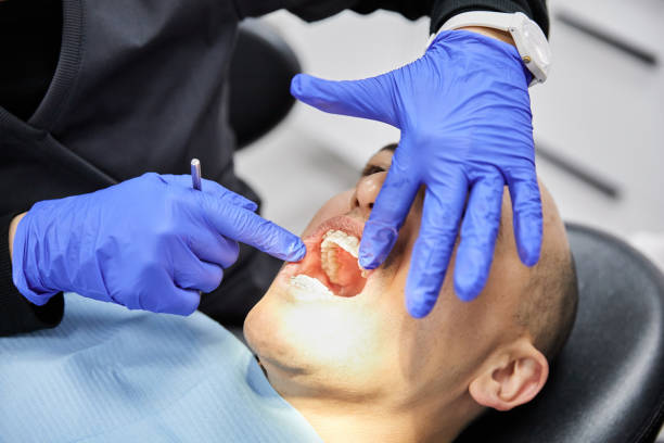 Best Weekend Emergency Dental Services in Buffalo, TX